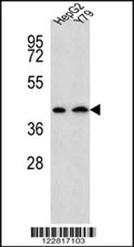 AADAT Antibody (Center)