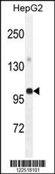 GPAM Antibody (Center)
