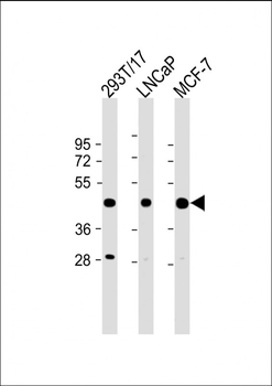 PRMT6 Antibody (N-term)