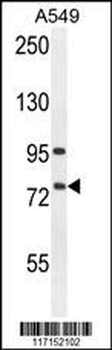 ALOX12B Antibody (C-term)