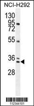BCA3 Antibody (N-term)