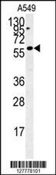 PARPBP Antibody (C-term)