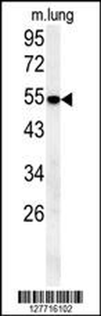 SLC43A2 Antibody (Center)
