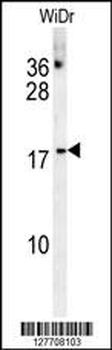 CHCHD2 Antibody (Center)