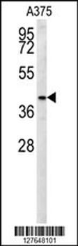 S35B2 Antibody (C-term)