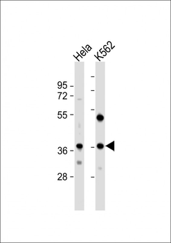 CTDSPL Antibody (N-term)