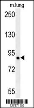 LRRC4B Antibody (N-term)