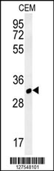 RSRC1 Antibody (Center)