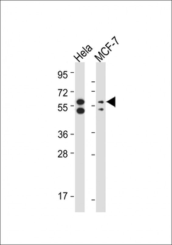 PINK1 Antibody