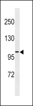 FGA Antibody (N-term)