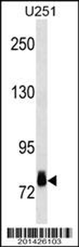 RPS6KA3 Antibody
