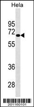 NUAK2 Antibody
