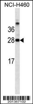 LGALS3 Antibody (C-term)