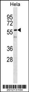 Vimentin Antibody