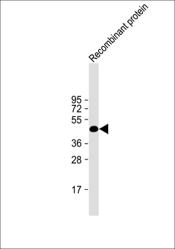 H1L Antibody