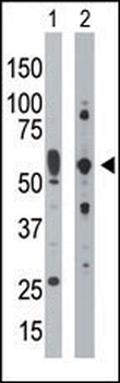 PKR (PRKR) Antibody (C-term)