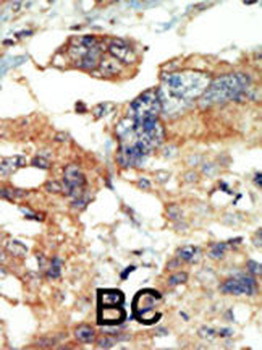 PI4KCB Antibody (N-term)