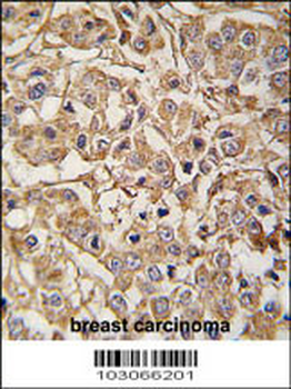 MYLK3 Antibody (N-term)