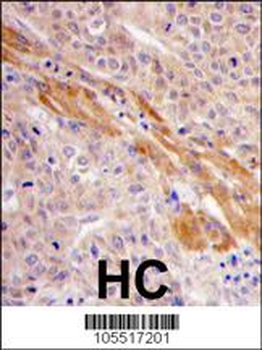 PGK1 Antibody (Center S320)