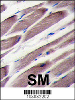 LATS2 Antibody (Center)