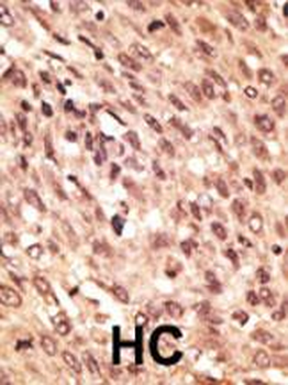 LRP5 Antibody (C-term)