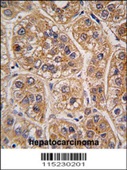 AKR1A1 Antibody (C-term)