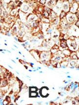 Ubiquilin1 Antibody (Center)