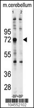 Ubiquilin1 Antibody (N-term)