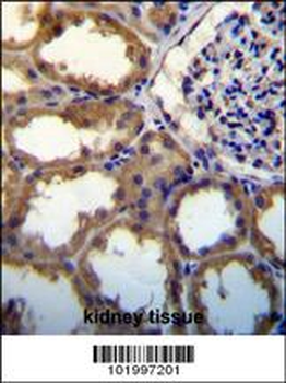 PDGFC Antibody (N-term)