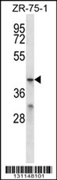 MFSD2B Antibody (C-term)