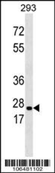 ABAD Antibody (C-term)