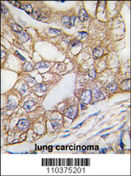 Ihh Antibody (N-term)
