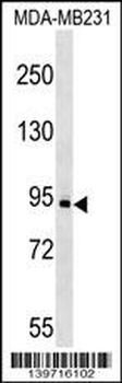 KIT Antibody (C-term S821/Y823)