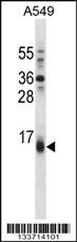 BBC3 Antibody (Center)