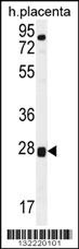 TOR2A Antibody (Center)