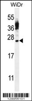 CT45A4/CT45A3/CT45A2/CT45A1/CT45A6 Antibody (Center)