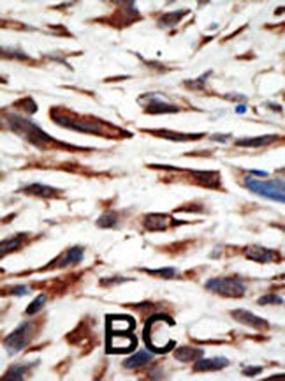 SET1 Antibody (N-term)