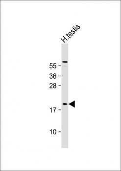 CT45A Antibody (Center)