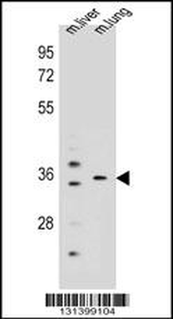 KCNRG Antibody (C-term)