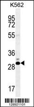 CT45A Antibody (N-term)