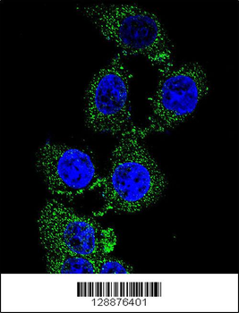ZGRF1 Antibody (N-term)