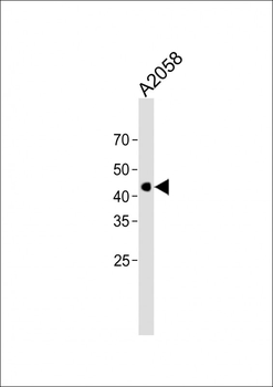 anti-MEK1 Antibody
