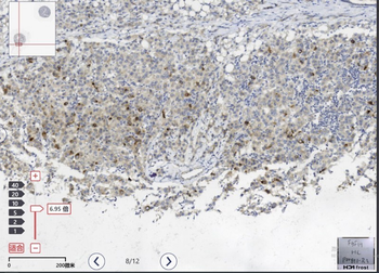 FGF19 antibody