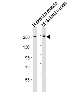 MYH6 Antibody (Center)