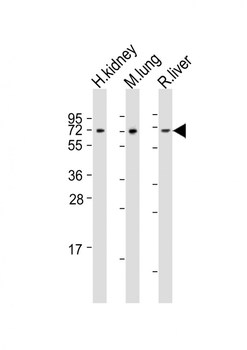 ACSF2 Antibody (Center)