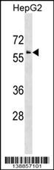 IRG1 Antibody (Center)