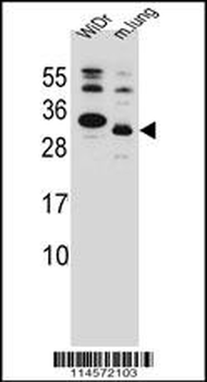 KRAS2 Antibody (C-term)
