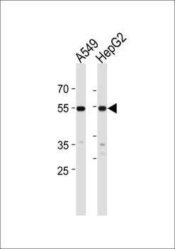 ALDH2 Antibody