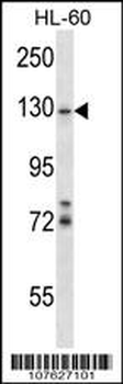 LLGL1/2 Antibody (Center S645/S649)