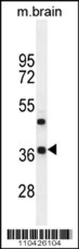 Rax Antibody (N-term)